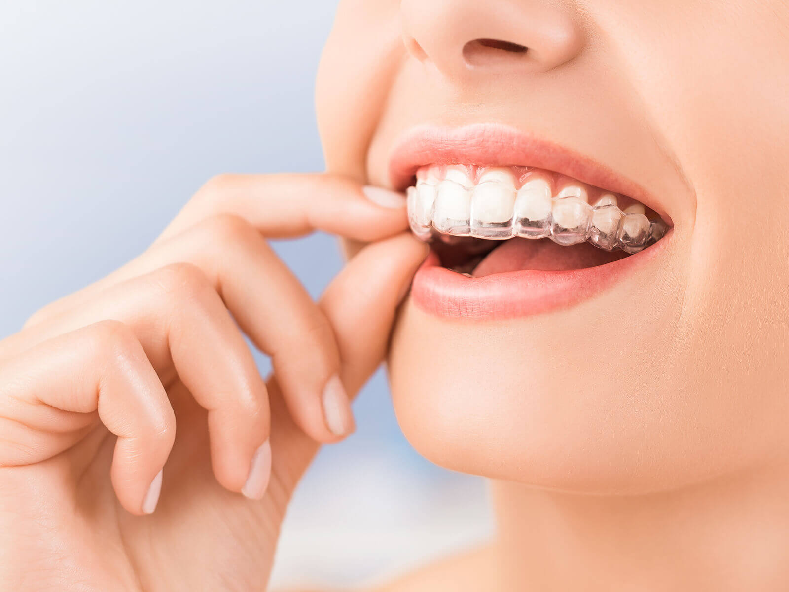 How long do you wear Invisalign every day?