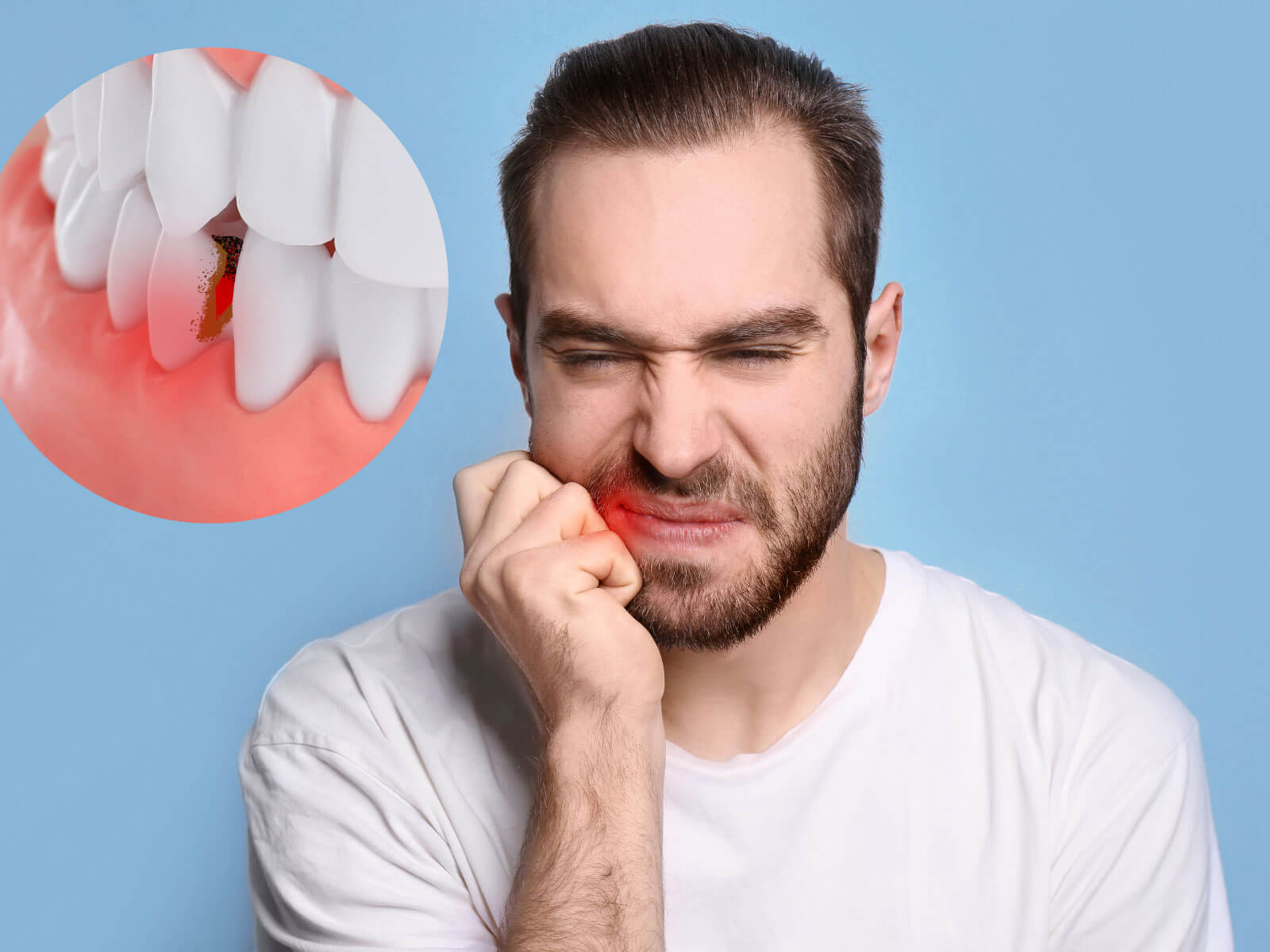 Swollen Gums: Causes, Treatments & When to See a Dentist